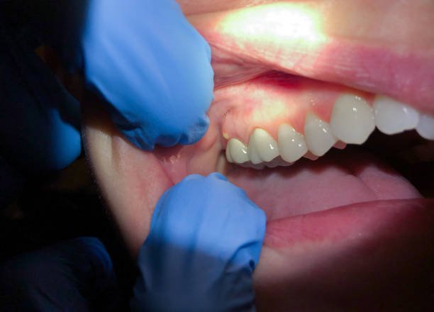 Best Emergency TMJ Treatment in Woodlawn, MD